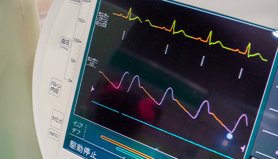 心電図検査